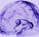 Wetenschappers ontdekken compleet nieuw vatensysteem in de hersenen