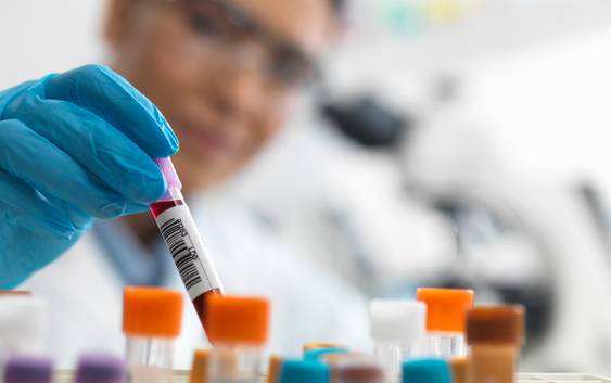 Honderden Belgische onderzoekers publiceerden in 'neptijdschriften'