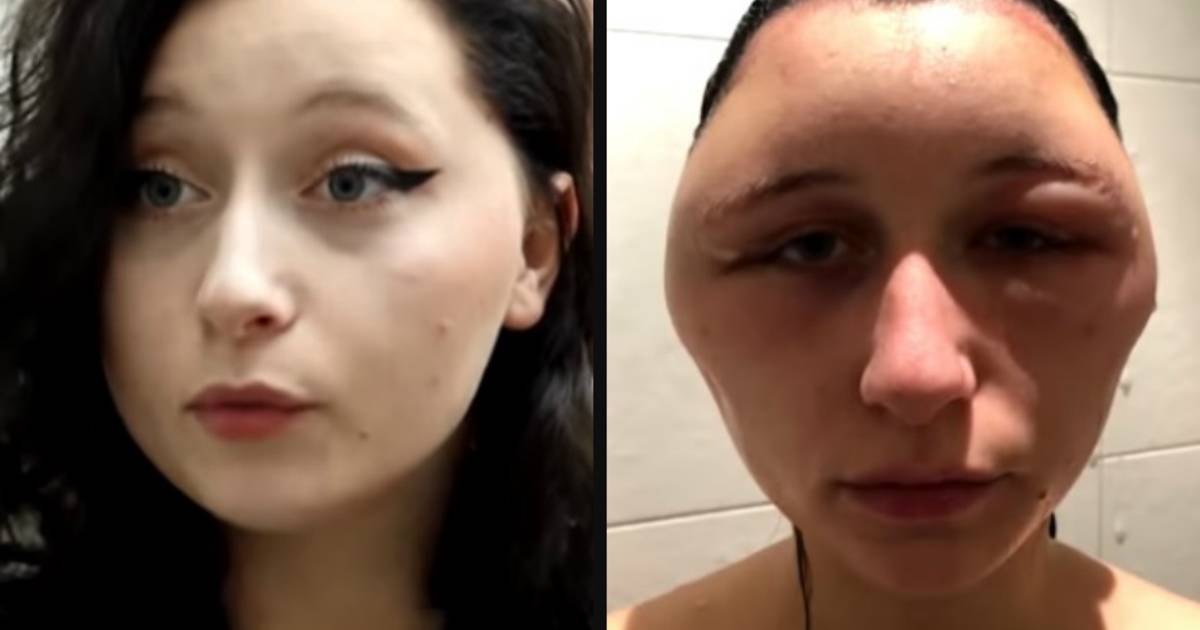 Mijn Hoofd Zag Eruit Als Een Gloeilamp Haarkleuring Van Estelle Loopt Helemaal Fout Bizar Hln Be