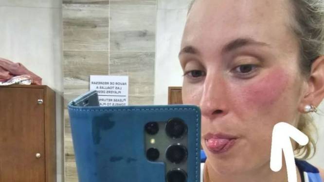 Une victoire qui laisse des traces: Elise Mertens frappée par une balle en plein visage
