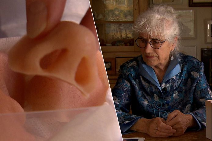 KIJK. Nederlandse Anita draagt al 11 jaar protheses na neusamputatie wegens  zeldzame kanker: “Ik heb voorraad zomer- en winterexemplaren” | Medisch |  hln.be