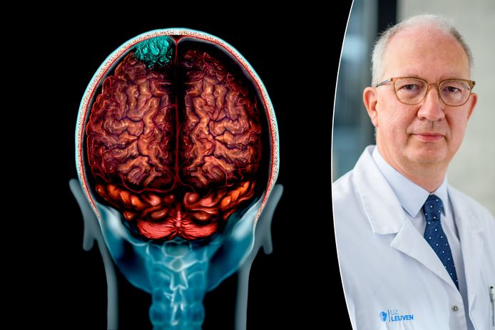 Neurochirurg prof. dr. Johannes van Loon van het UZ Leuven geeft meer uitleg bij hersentumor.