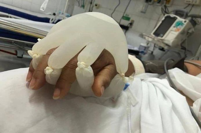 De 'Hand van God' die gebruikt wordt in een ziekenhuis in Brazilië waar mensen helemaal alleen sterven.
