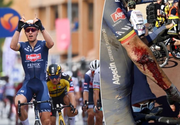Tim Merlier won vorig jaar nog een etappe in de Giro (links), maar moet dit jaar passen door een elleboogblessure die hij opliep in Parijs-Roubaix.