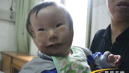Un Bebe Ne Avec Un Masque Sur Le Visage Video Insolite 7sur7 Be