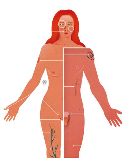 Slecht zicht, overbeharing of urineverlies? De laser lost het op