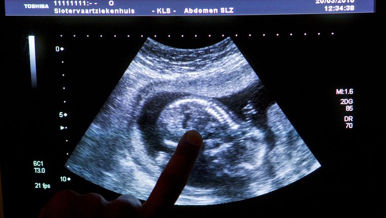 Echo in het Slotervaartziekenhuis in Amsterdam. Beeld anp
