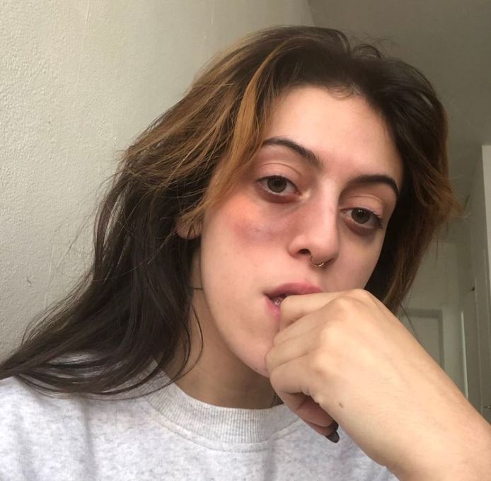 Clara, 21 ans, a été agressée devant sa porte.