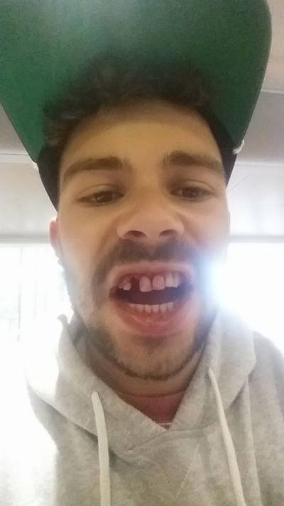 Dave uit Leiden schrijft emotioneel bericht na mishandeling op straat