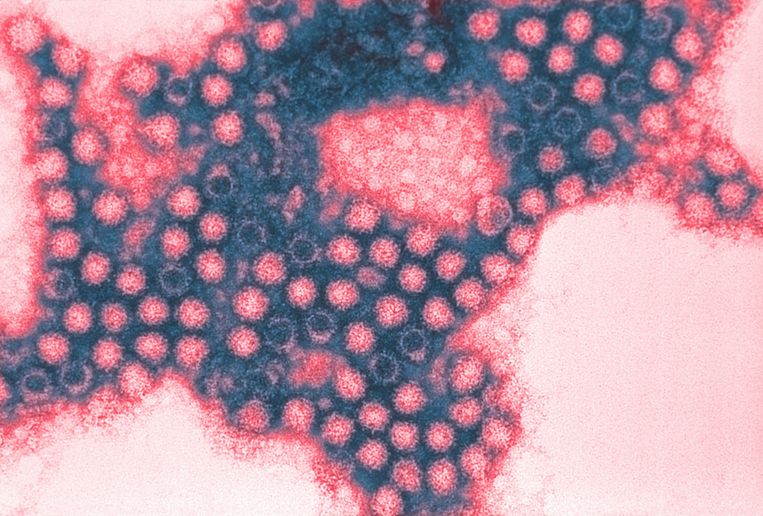 Het coronavirus onder de microscoop. Beeld Getty Images/Image Source