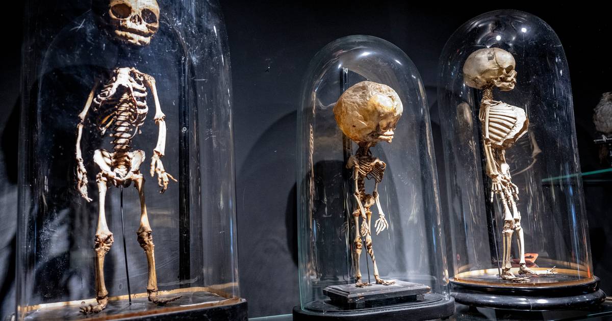 Skelet van waterhoofdbaby te koop in deze winkel ‘Moeder