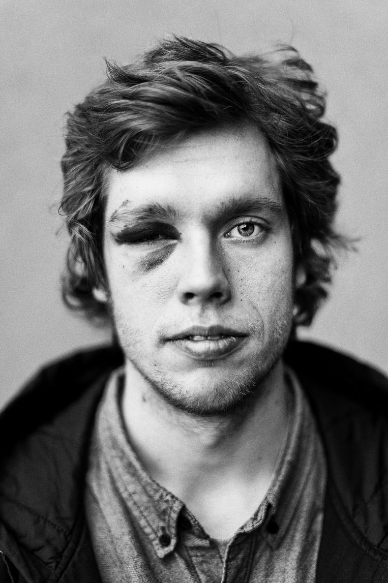 Au! Beeld Thomas Sweertvaegher