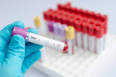 Une Italienne reçoit 145.000 euros après avoir contracté le sida dans un laboratoire à Genève