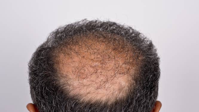 Wetenschappers Ontdekken Waarom We Haar Verliezen Als We Ouder Worden Wetenschap Planeet Hln Be