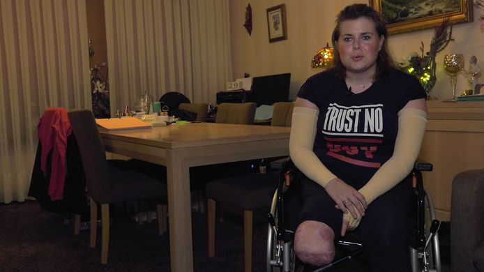 De 23-jarige Liza Veerman verloor haar onderbenen door een infectie met meningokokken type W.