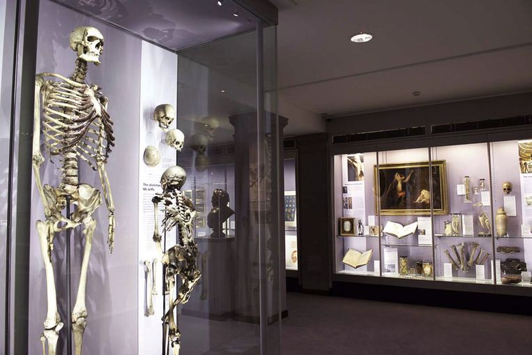 De Ierse Reus in het Hunterian Museum. Beeld afp