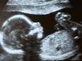 Opschudding in Argentinië: twee tienermeisjes van 10 en 11 blijken hoogzwanger
