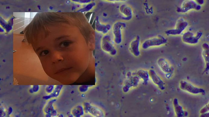 David Pruitt (inzet) overleefde een infectie met de parasiet naegleria fowleri (achtergrond) niet.