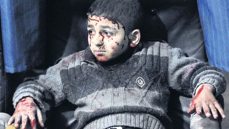 Gewond kind in de Syrische hoofdstad Damascus Beeld Reuters