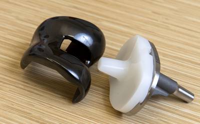 Chirurg stelt aan hand prothese identiteit van gecremeerde Bornse vast: ‘Dit moet veel vaker voorkom