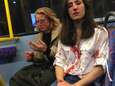 Une hôtesse de l’air et son amie tabassées dans le bus car elles refusent de s’embrasser