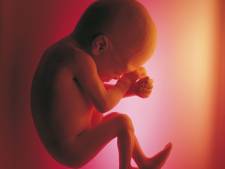 “Première mondiale” et “prouesse médicale” en Belgique avec le traitement d’une malformation vasculaire in utero