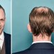 Ook deze mannen gingen op hun eigen manier om met haarverlies: ‘De tijdwinst is fantastisch’