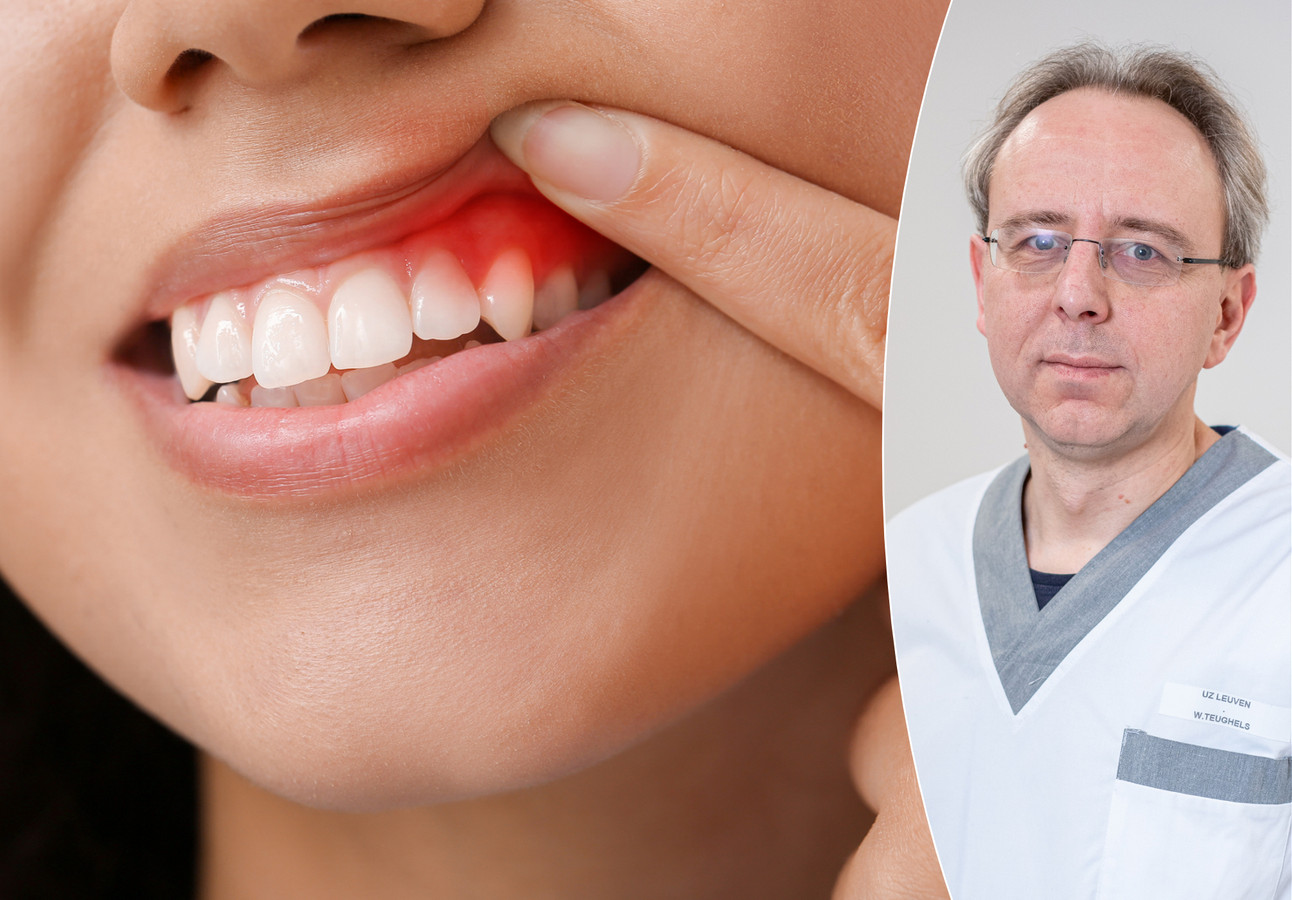 Parodontoloog over terugtrekkend tandvlees “Let op met harde tandenborstels en piercings
