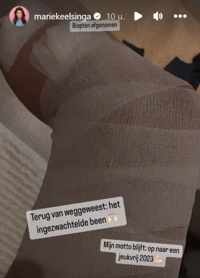 Marieke Elsinga heeft een ingezwachteld been vanwege de extreme jeuk.