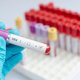 Onderzoek brengt langwerkend hiv-medicijn stap dichterbij