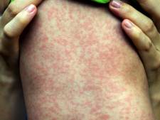 'Vaccinaties scheelden duizenden doden in Nederland'