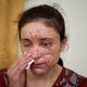 Aan IS ontsnapte Yezidivrouwen winnen mensenrechtenprijs
