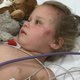 2-jarige Amy in ziekenhuis door doorrijder