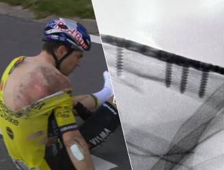 LIVEBLOG. Van Aert en Stuyven gingen intussen onder het mes, Lidl-Trek-renner: “Een enorme klap, maar operatie is geslaagd”
