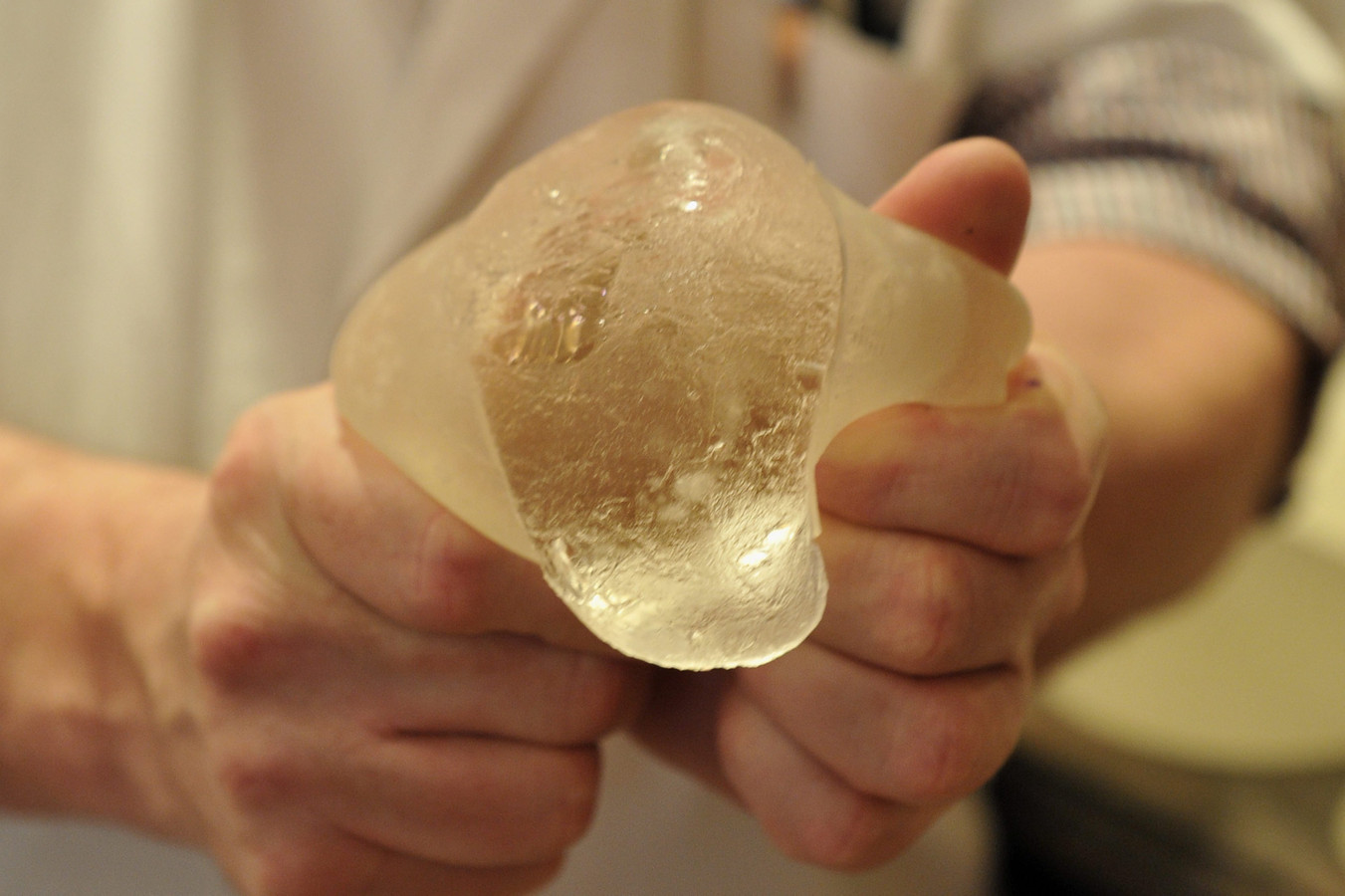 Een plastisch chirurg toont een kapotte silicone borstimplantaat van PIP