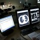 KWF wil financieel plafond voor kankermedicijnen
