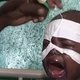 Verenigde Naties: 'Hongersnood in Afrika de grootste humanitaire ramp sinds de Tweede Wereldoorlog'