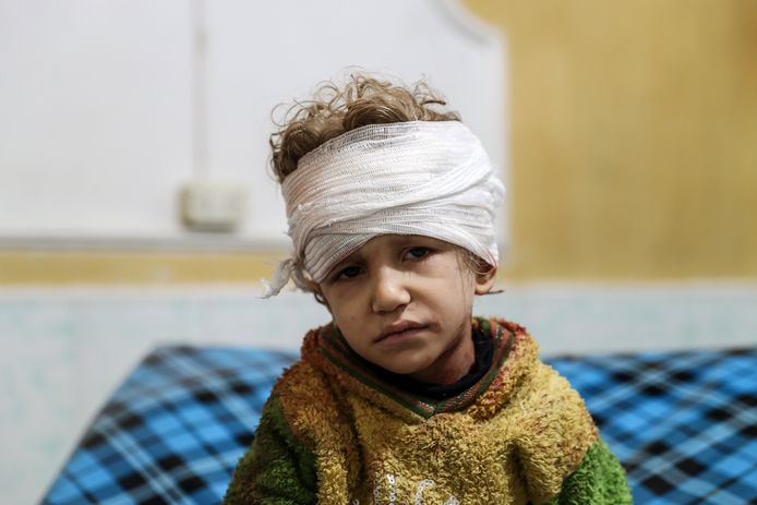 Een kind uit Oost-Ghouta in Syrië is gewond geraakt bij een aanval.
