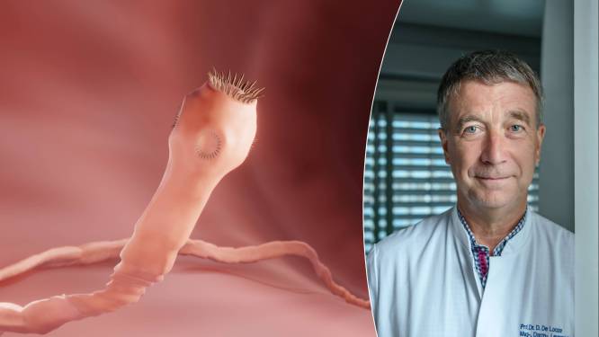 Heb je last van vage buikpijn en krampen? Misschien is het wel een lintworm: “Ze kunnen tot 10 meter lang worden”