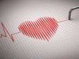 Onderzoekers ontwikkelen nieuwe screeningstest die kans op plotse hartfalen beter inschat