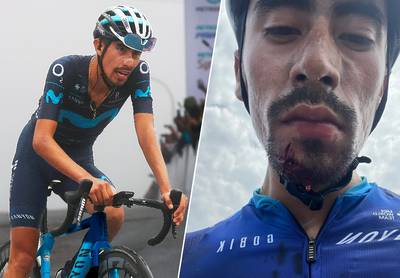 Movistar-renner Ivan Sosa gewond aan gezicht nadat vrachtwagenchauffeur hem toetakelt met revolver
