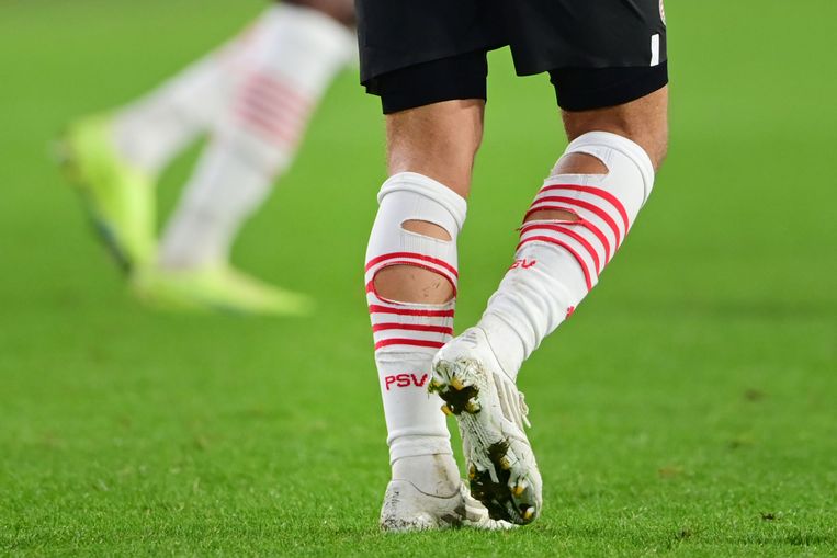 Invloedrijk verkwistend grote Oceaan Nieuwste trend in voetballand: gaten in sokken tegen kuitkramp