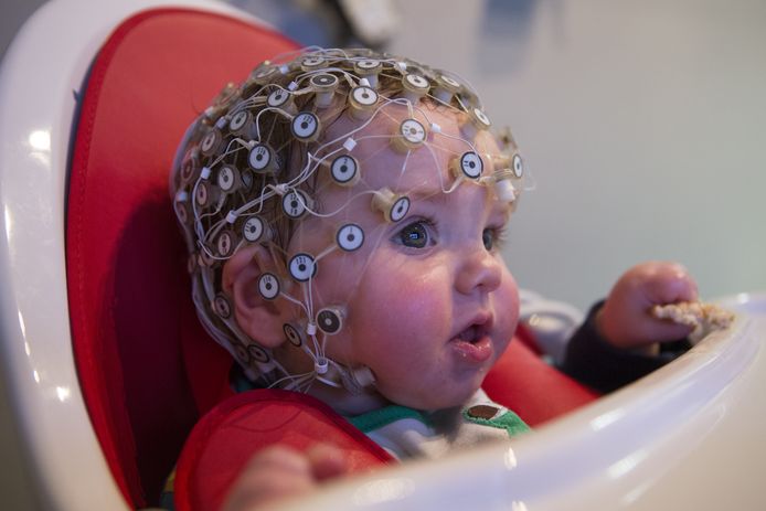 Illustratiefoto van een jongetje van negen maanden met sensoren op het hoofd om een elektro-encefalogram te maken.