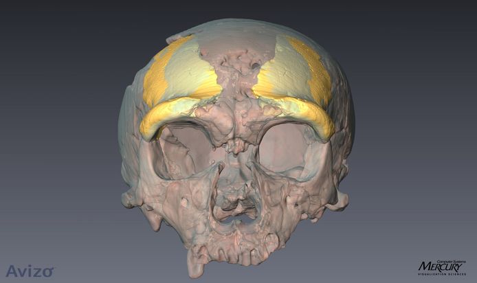 Een reconstructie van een schedelfragment van meer dan 40.000 jaar oud.