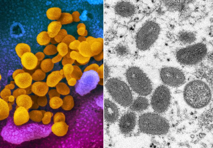 Links een foto van het coronavirus onder een microscoop, rechts een foto van het apenpokkenvirus.