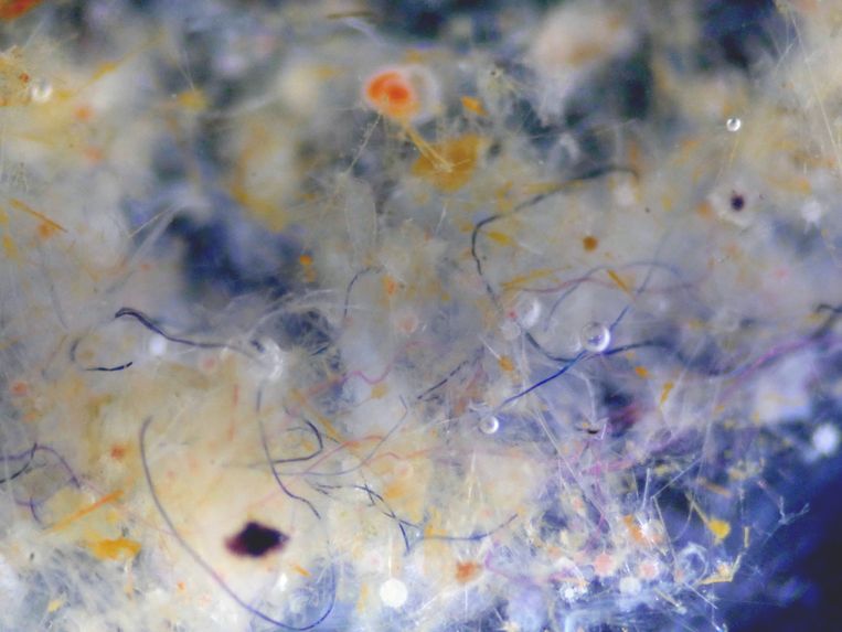 Textielvezels verknoopt met plankton.  Beeld Patti Virtue (UTAS)