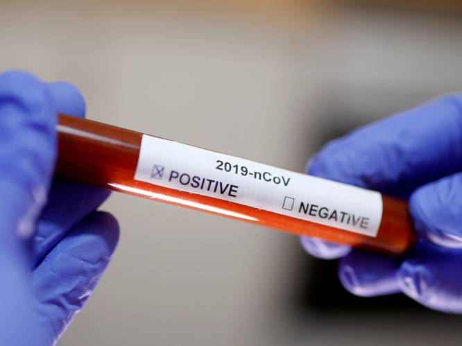Officieel 1.243 Belgen besmet met coronavirus, in werkelijkheid tien keer zoveel