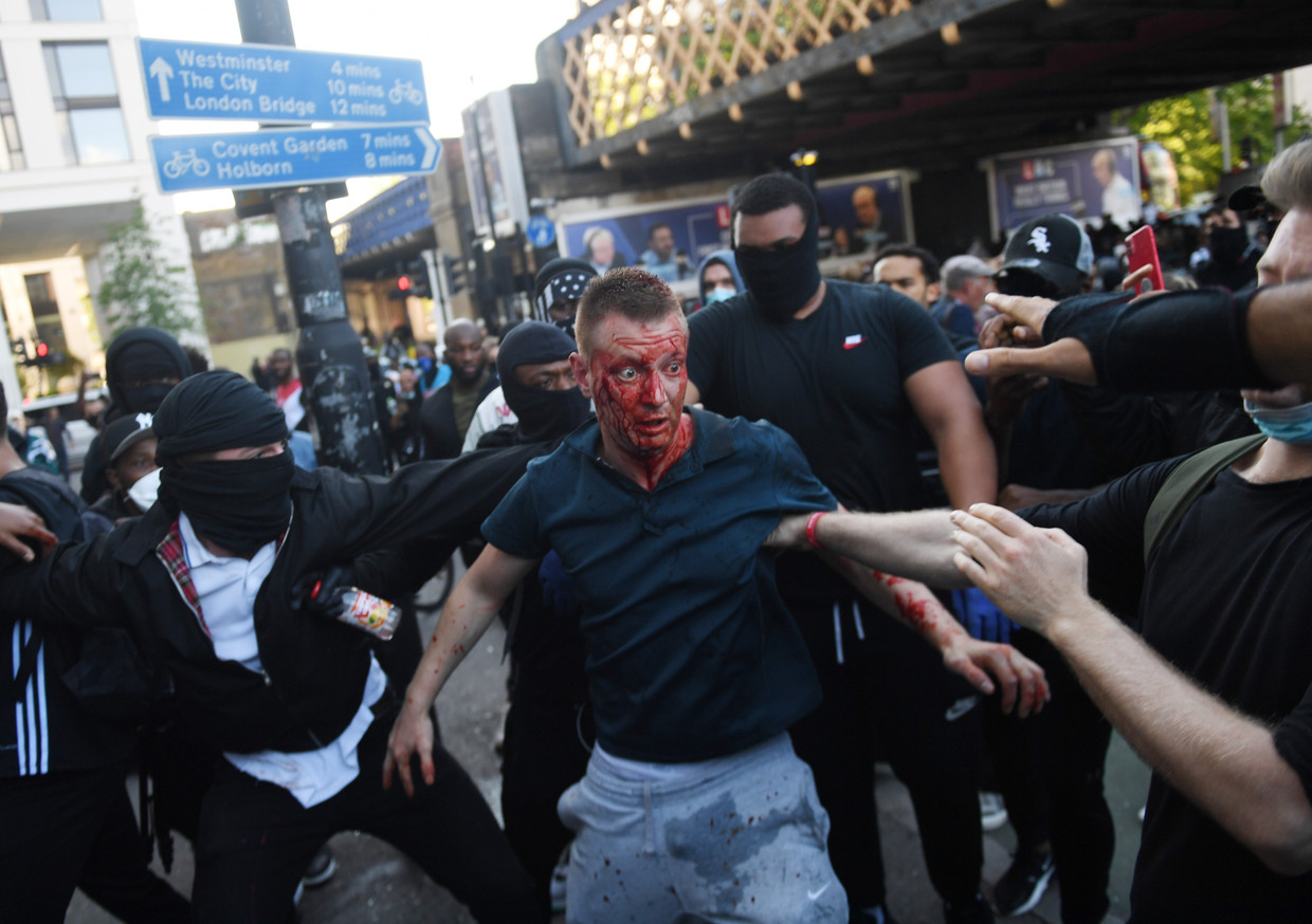 Een gewonde betoger in Londen. Beeld EPA