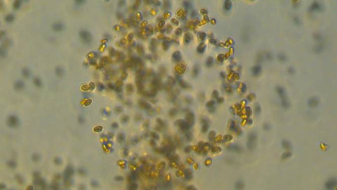 Microbe ontdekt die ingezet kan worden als 'geheim wapen' tegen klimaatopwarming