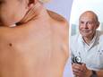 Dermatoloog Thomas Maselis is opgetogen over het vooruitzicht van de nieuwe therapie tegen huidkanker.